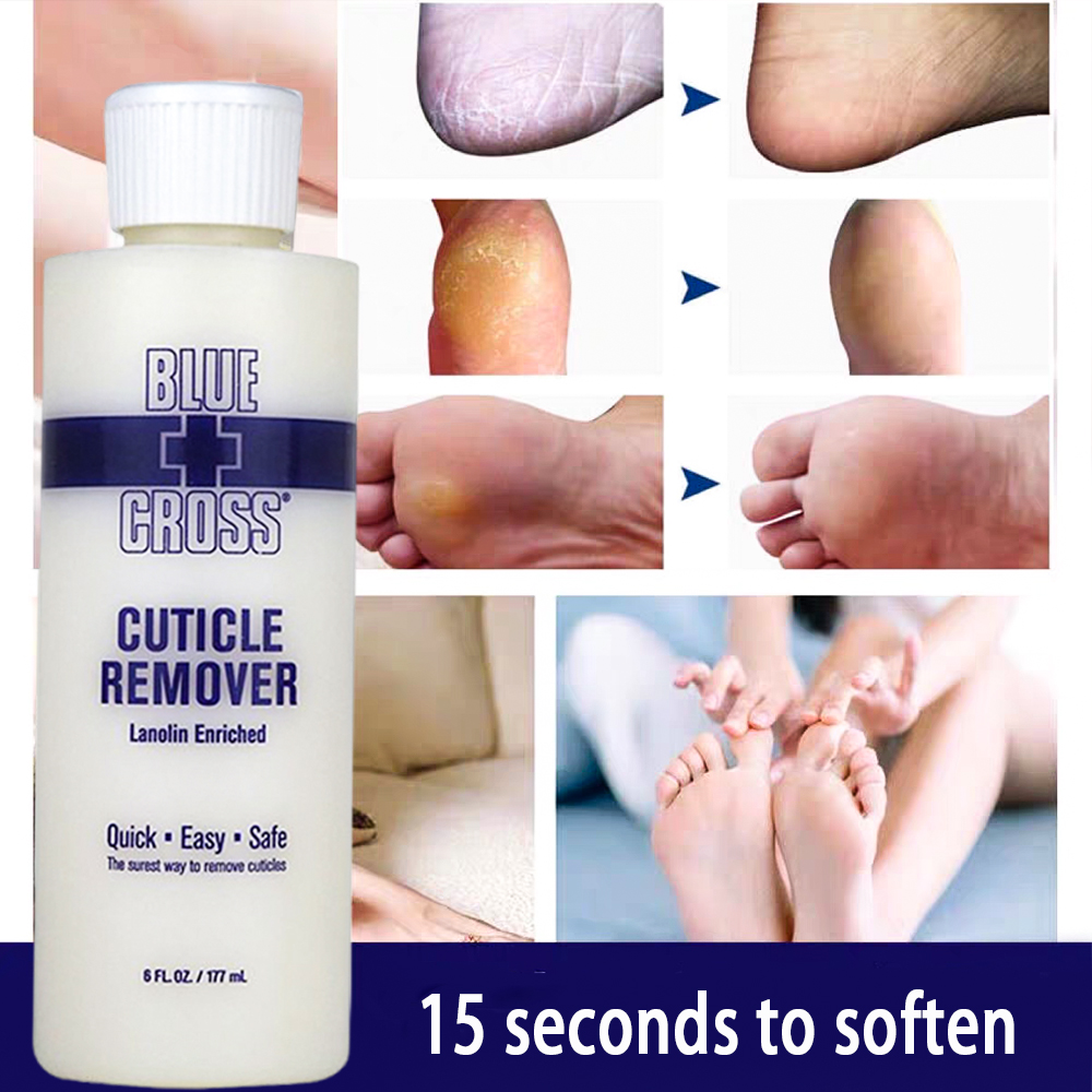Foot Mask Peeling - 발 각질 제거제, 발 각질 연화제,