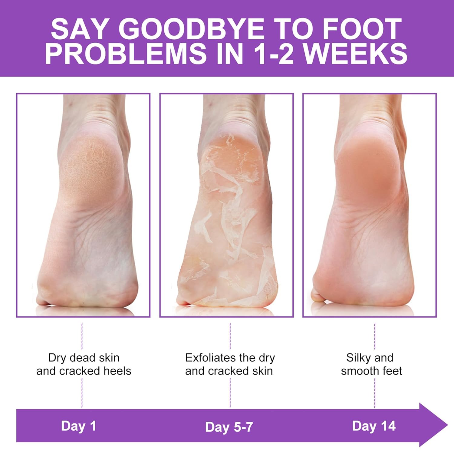 각질 제거 필링 콜러스 발바닥 마스크 양말 제거제 스파 - Foot Mask Peeling 리뷰 및 가격