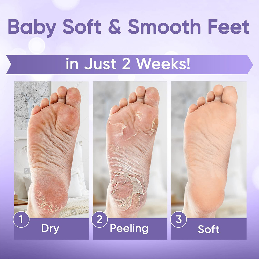1-20Pair 엑스 폴리 에이 팅 피트 마스크 엑스  - Foot Mask Peeling 리뷰 및 가격